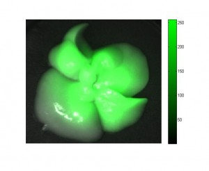 IR laser Image of Rat Liver